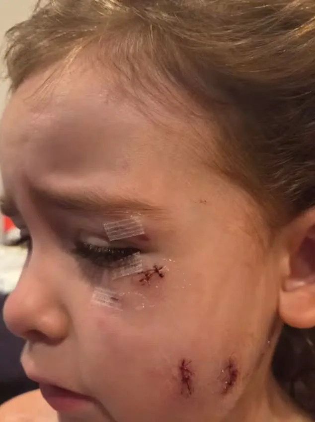 Urgent: Dog Attack in Oshawa Leaves Two Mothers and Child Injured on January 13