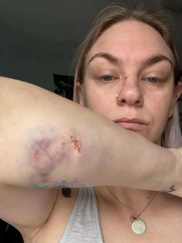 Urgent: Dog Attack in Oshawa Leaves Two Mothers and Child Injured on January 13