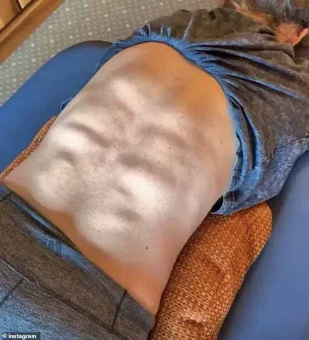 Mikaela Shiffrin Showcases Sculpted Back Muscles, Highlighting Rigorous Training and Athletic Challenges