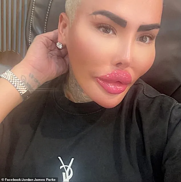 Flamboyant TV Personality 'The Lip King' Dies; Police Probe Cosmetic Procedure Link