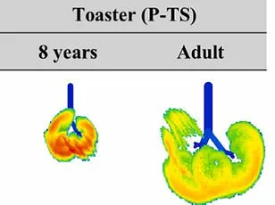 Air Fryers: The Healthy Option or Kitchen Danger?