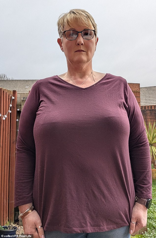 Joanna Brice seeks NHS funding for life-changing surgery after years of bullying and pain.