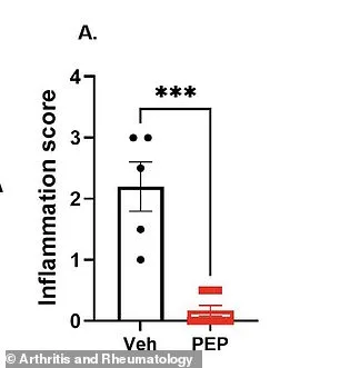 New Therapy Hope for Inflammatory Arthritis