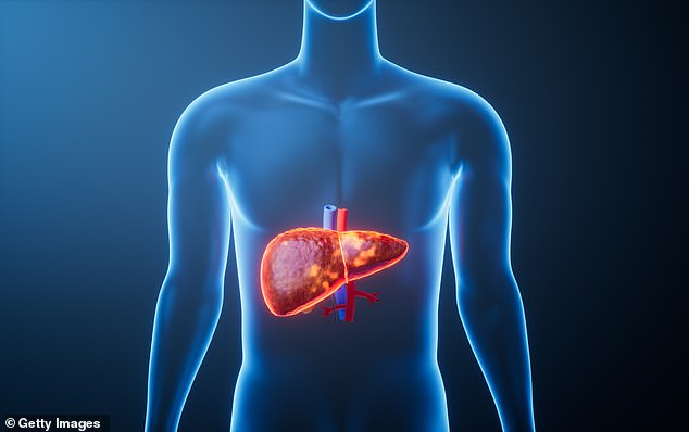 Obesity and heavy drinking combine to silently fuel a deadly liver disease epidemic.