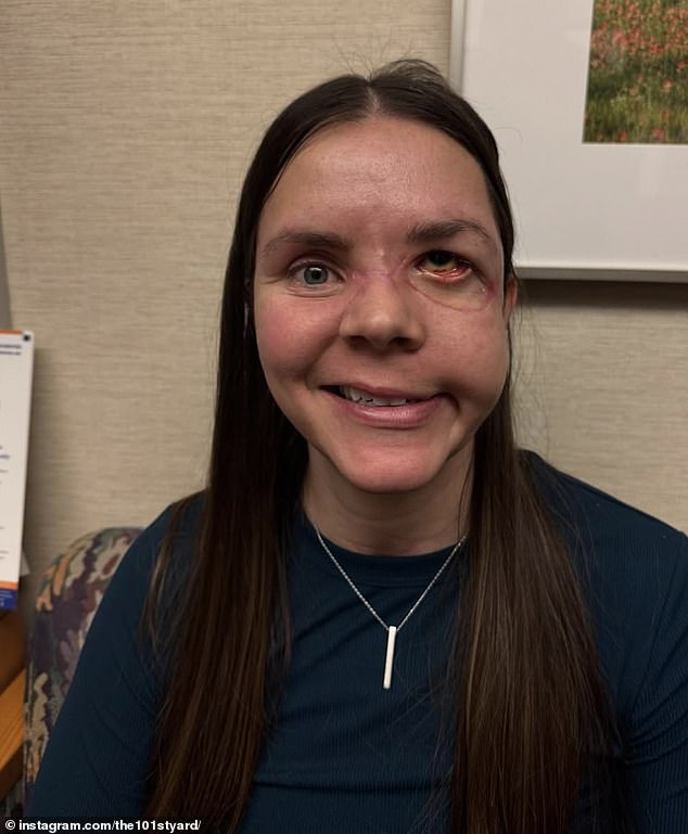 Kenai Mother Reveals Terrifying Details of Grizzly Bear Attack