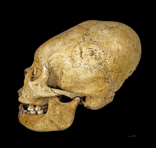 DNA study fails to confirm alien origins of ancient Peruvian conehead mummies.